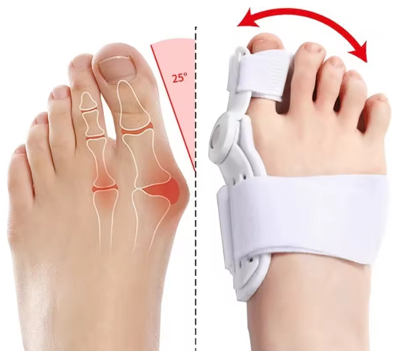 CORRECTOR DE JUANETES SMART TECHNOLOGY